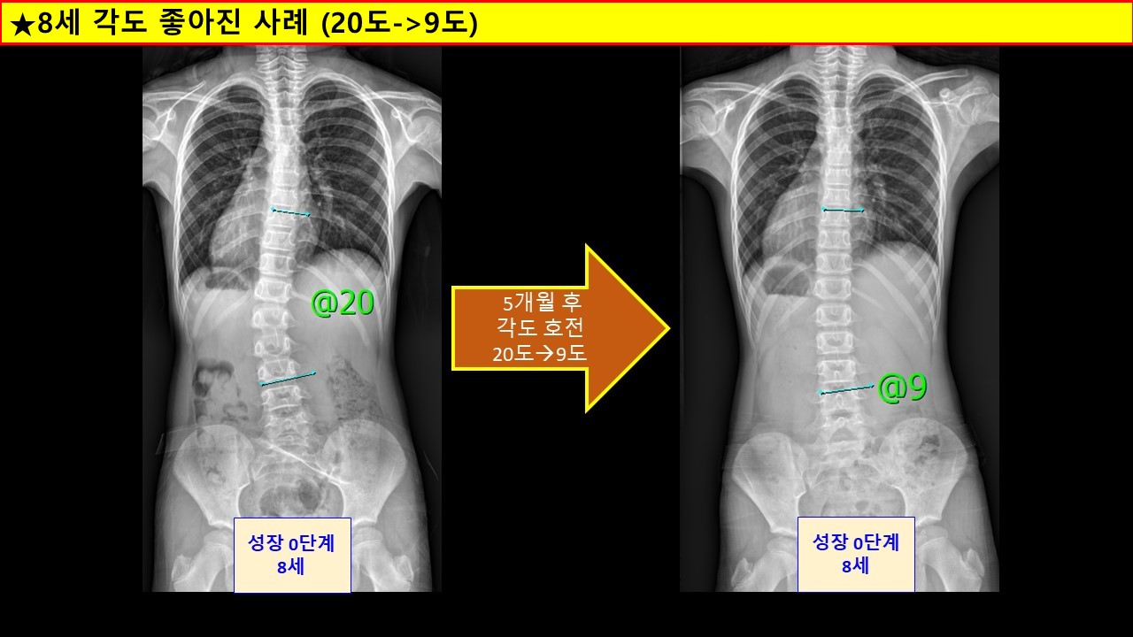 8세.jpg